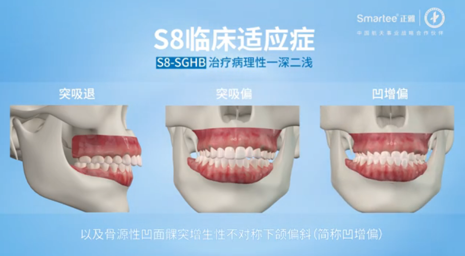 正雅S8-SGTB与S8-SGHB之异同点解析_互联网_贝塔网